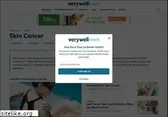 skincancer.about.com